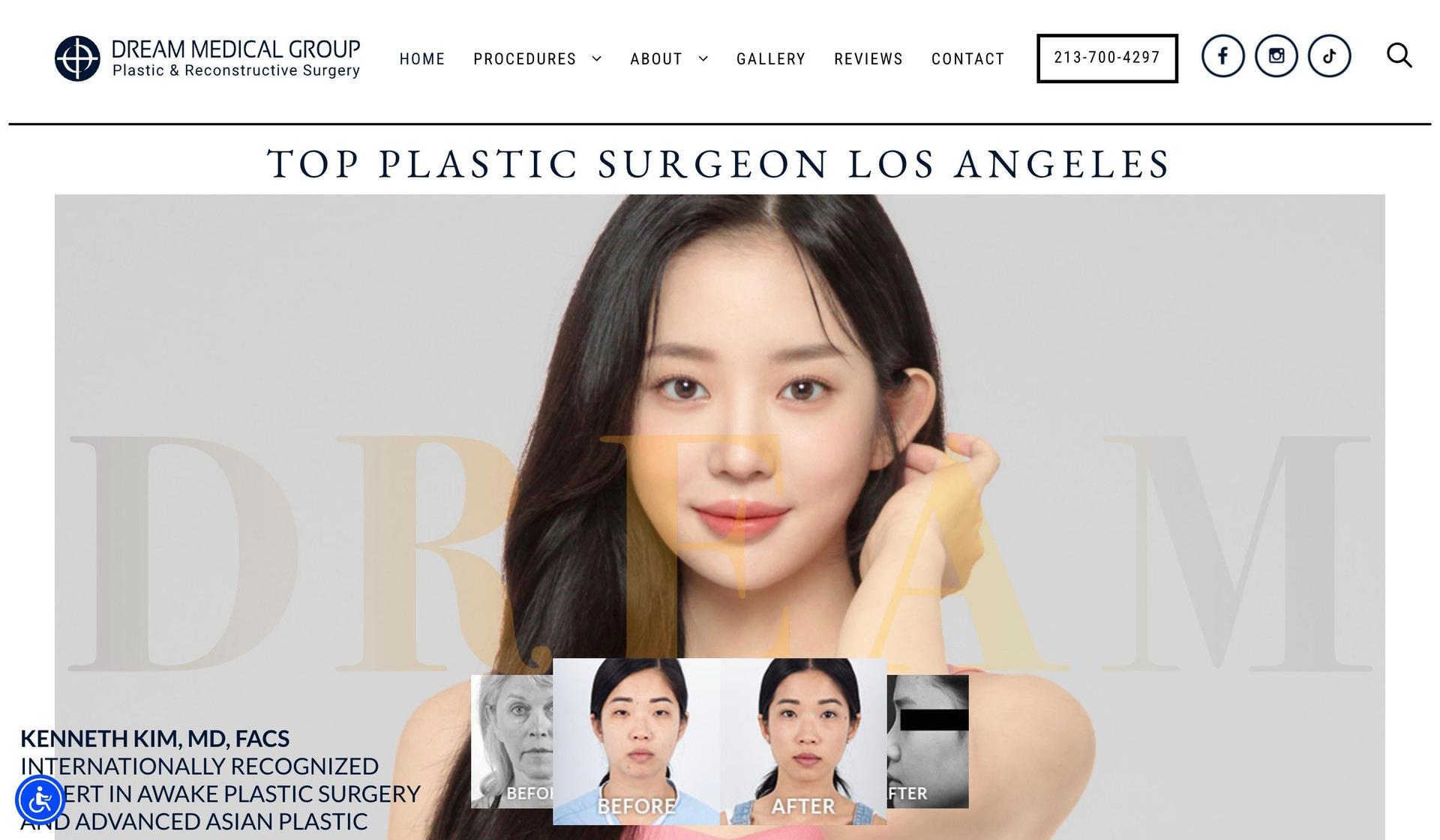 Dr. Kenneth Kim-plastic surgery websites